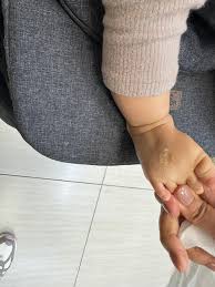 要多準有多準🐦💩 原來女兒也是這種體質🤣 育兒日常