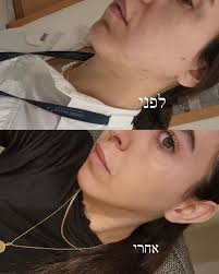 קוסמטיקאית מוסמכת 🦋‎ (@hanadi_nasraldeen1) • Instagram photos and videos