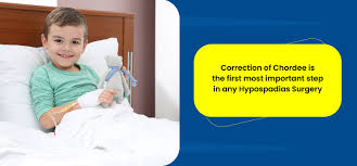 Image result for Chordee