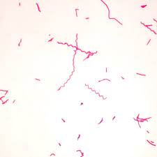A microbial biorealm page on the genus rhodospirillum rubrum. Rhodospirillum Rubrum Typical Spirillum W M Microscope Slide Carolina Com