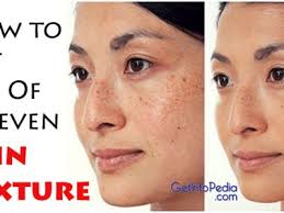 Dry skin, enlarged pores, age spots caused by sun damage, skin a dull color, deep pox scars. Even Skin Tone Naturally Archives Getinfopedia Com