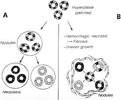 Pathogenesis Of Thyroid Nodules Histological Classification Sciencedirect