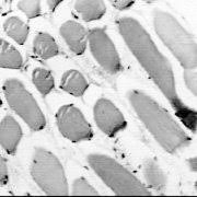 Un corte de luz (los cortes de luz pueden ser urgentes si se produce un corte de luz, la instalación conmuta automáticamente al funcionamiento con batería y sigue alimentando . Microscopia De Luz P A S Corte De Musculo Estriado Esqueletico Download Scientific Diagram