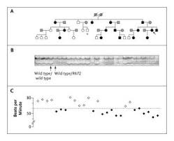 Familial Sinus Bradycardia Associated With A Mutation In The Cardiac Pacemaker Channel Nejm