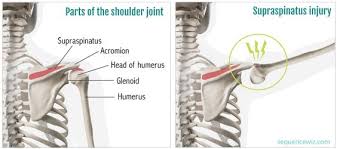 Pin On Joga Articles