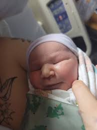 Baby born after c-section delivery
