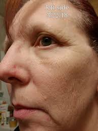 Do any ladies know of an anti wrinkle cream that actually works? I know I'm  only young but would like to try them out see if they make any difference 😊