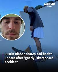 Bieber detailed his latest injury 😱👀  https://www.tyla.com/entertainment/celebrity/justin-bieber-skateboarding-accident-twitch-529933-20251117