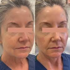 Love learning from the BEST! Thank you Allergan, you did it again! Chic  restaurant, awesome food and drinks, and of course, the wisdom of Dr. Deb  Sherman. It all is making sense!