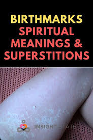 Birthmark On Leg Meaning Birthmarks Spiritual Meanings Superstitions Insight State Spiritual Meaning Birthmark Spirituality