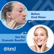 Kind Water Systems (@kindh2o) · Instagram 照片和视频