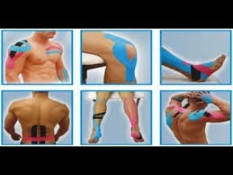 Pin En Tratamientos Cintas Kinesiologicas
