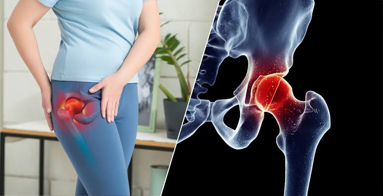 How To Relieve Hip Pain?