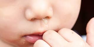 Anda bisa menggunakan obat bisul topikal yang dijual bebas di apotek untuk dioleskan pada bisul yang terasa sakit, atau luka bekas bisul yang pecah. Hidung Berair Pada Anak Begini Cara Mengatasinya