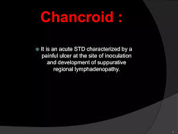Image result for chancroid