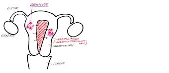 Welche medikamente beeinflussen das volumen der gebärmutter? Endometriose Kantonsspital Baden Ksb