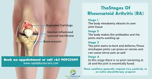 Pin On Physiotherapy Singapore 3025