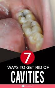 People may develop white spots on their teeth due to an excessive fluoride intake known as fluorosis or due to demineralization from acidic beverages. Pin On Health And Wellness