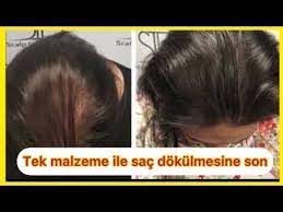 1 Tek Malzeme Ile Sac Dokulmesine Karsi Cozum Sac Cikaran Uzatan Tarif Youtube 2020 Sac Sac Bakimi Youtube