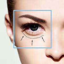 Di zaman milenial ini banyak orang mengabadikan moment tertentu melalui foto, dari usia yang muda maupun yang tua. Eyebag