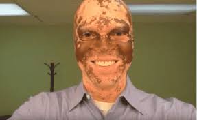 Television Reporter Reveals Drastic Secret