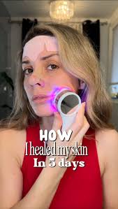 MYSKINBUDDY