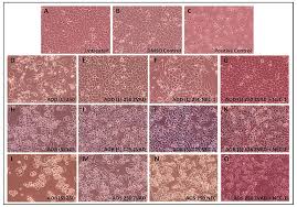 Image result for Acridocarpus chloropterus