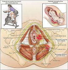 Image result for Pudendal Block