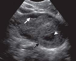 Check spelling or type a new query. Imaging Of The Female Pelvis Through The Life Cycle Radiographics