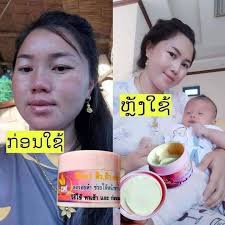 ຄີມD99 muaj xa nb xav tau tu nqi pheej msg kv nawb