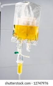Image result for Plasma Transfusion