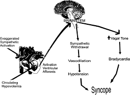 Vasovagal syncope is usually harmless and requires no treatment. The Elusive Pathophysiology Of Neurally Mediated Syncope Circulation
