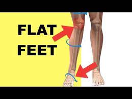 Pin On Slant Board For Patellar Tendonitis