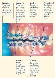 About Us Orthodontics In Kent Belli Streit Orthodontics Dental Braces Orthodontics Dental