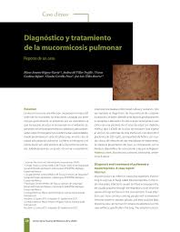 El tratamiento de la mucormicosis rinoorbitocerebral. Pdf Diagnosis And Treatment Of Pulmonary Mucormycosis A Case Report