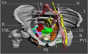 We did not find results for: A Computer Model Of The Female Pelvic Floor Including Bony Pelvis Download Scientific Diagram
