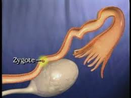 Ask your own health question. Tubes Tied Tubal Reversal Video Youtube