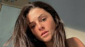 Preminula 27-godišnja tiktokerica koja se borila s rijetkom bolesti, o  svemu je otvoreno pričala na društvenim mrežama