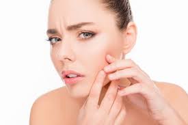 Muchas veces se tienen retratos o fotos carnet que deben ser retocadas para tener una cara más clara y limpia, sin granos, arrugar y más. Como Quitar Marcas De Acne 8 Remedios Naturales Efectivos