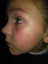 Remember the little girl we saw viciously beat