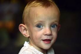 The miracle baby one year on: The little girl who still wears clothes for  babies aged three to six months but has overcome the unimaginable to take  her first steps