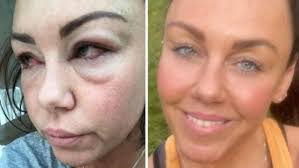 Michelle Heaton posts graphic photo of alcohol addiction