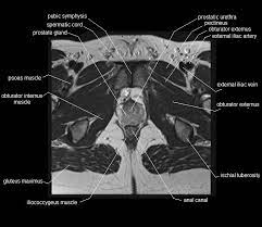 We'll go through the on this image, we can also see some of the muscles that we talked about specifically the slowest. Mri Pelvis Anatomy Free Male Pelvis Axial Anatomy