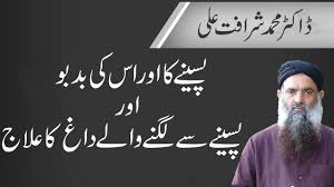 Pasina Ka Ilaj In Urdu