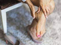 Cracked Heels Remedies Prevention And More