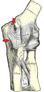 Ligaments the joint capsule of the elbow is strengthened by ligaments medially and laterally. Ulnar Collateral Ligament Of Elbow Joint Wikipedia