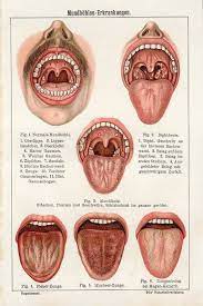 Understanding Receding Gums Healthy Medicine Tips In 2021 Tongue Color Health Anatomy Medical Causes Of Mouth Ulcers