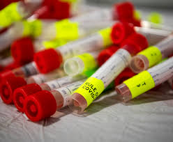 We encourage our patients to take their health into their own hands. Researchers Discover New Variant Of Covid 19 Virus In Columbus Ohio