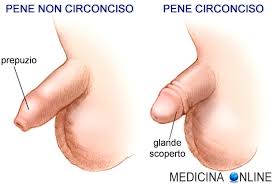 Differenza tra pene circonciso e “normale”: vantaggi e svantaggi | MEDICINA  ONLINE