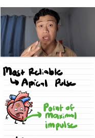Image result for Point of Maximum Impulse